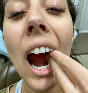 BCOH_Teledentistry_Kate_IMG_0837
