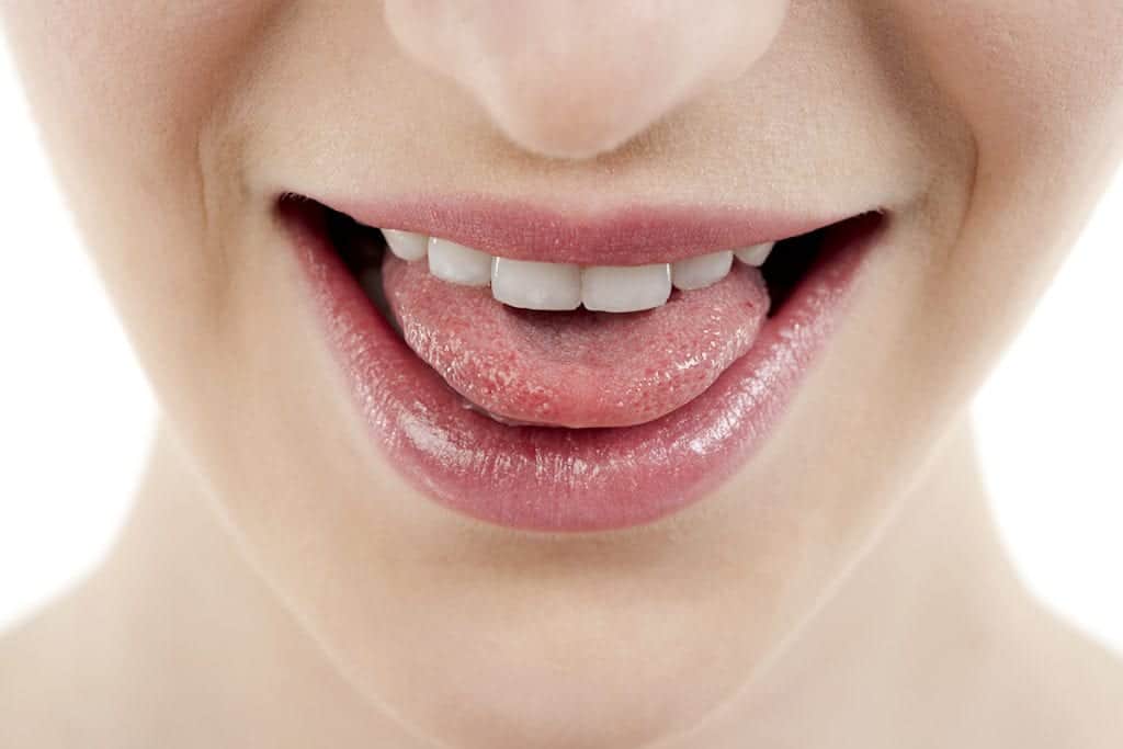 BCOH_TONGUE_CAUSING_AIRWAY_OBSTRUCTION