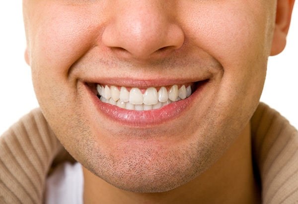 BCOH_Dental_Veneer_Treatment_Services